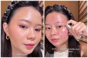 Tak perlu mix produk, ini cara pakai foundation di kulit berjerawat agar full coverage tanpa dempul