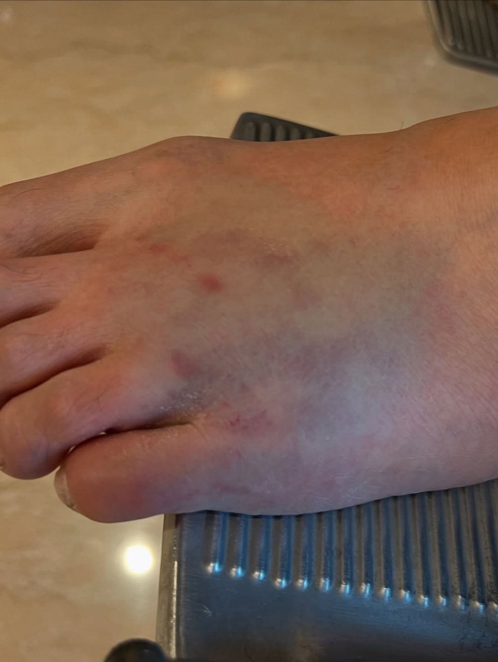 Kondisi Fairuz A Rafiq usai kakinya terinjak oleh sapi kurban dari Raffi Ahmad, alami memar