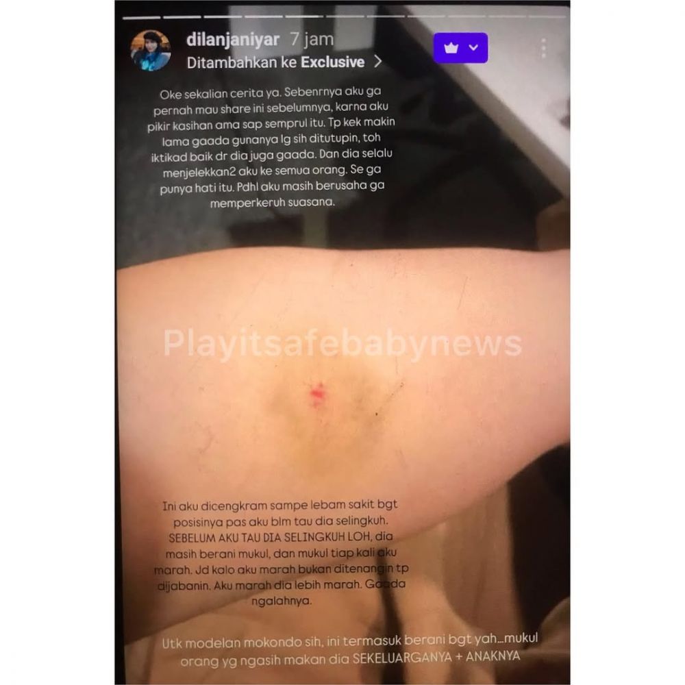 Sebelumnya ditutup-tutupi, Dilan Janiyar kini berani ungkap pernah alami KDRT dari Safnoviar