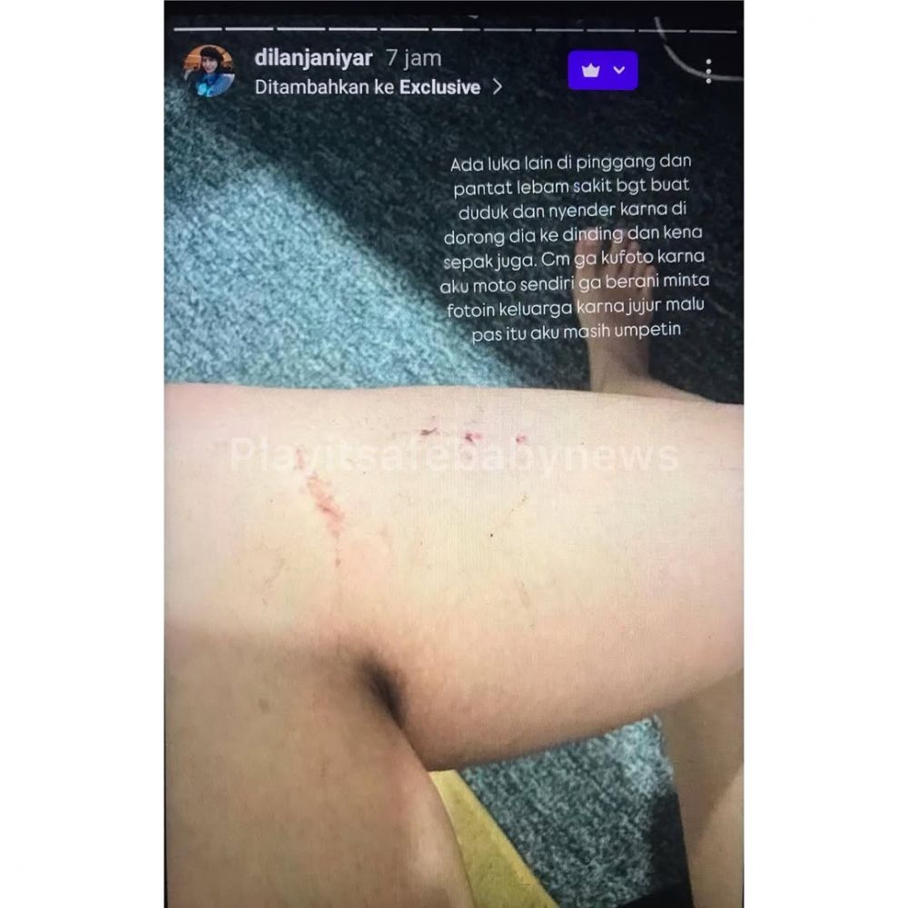 Sebelumnya ditutup-tutupi, Dilan Janiyar kini berani ungkap pernah alami KDRT dari Safnoviar