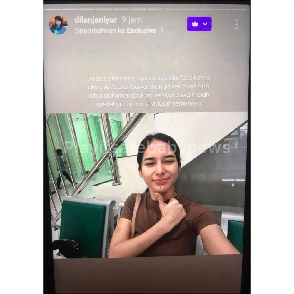 Sebelumnya ditutup-tutupi, Dilan Janiyar kini berani ungkap pernah alami KDRT dari Safnoviar