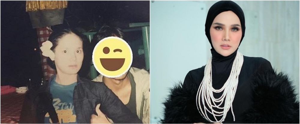 Bantah lakukan operasi plastik, ini 11 potret Mulan Jameela dulu dan kini yang wajahnya makin berubah