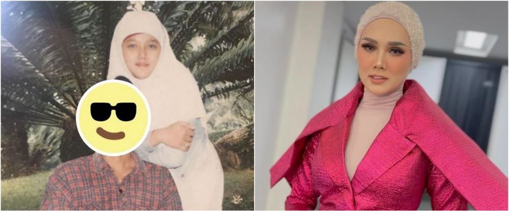 Bantah lakukan operasi plastik, ini 11 potret Mulan Jameela dulu dan kini yang wajahnya makin berubah