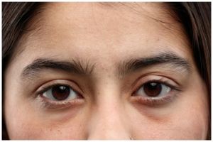 Tak perlu lagi dikompres timun, ini cara baru cerahkan kantung mata hitam pakai 1 jenis umbi-umbian