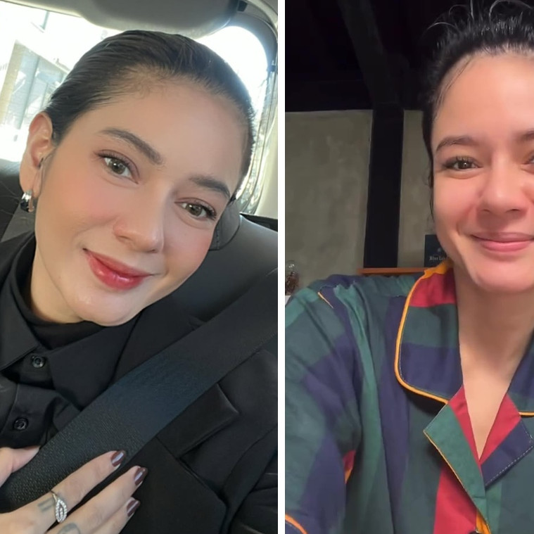 Modal Rp0, rutinitas skincare pagi ala Citra Anindya pacar Chef Juna ini bikin mulus bebas jerawat