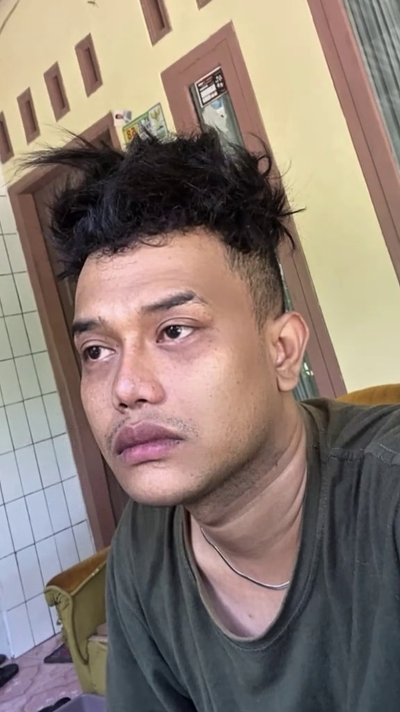 Muak gagal dapat pekerjaan karena dinilai fisiknya, pria ini oplas, 7 perubahannya bak beda orang