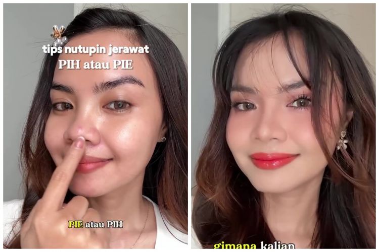 Bukan pakai color corrector oranye, ini trik tutup bekas jerawat sebelum makeup agar makin tersamarkan