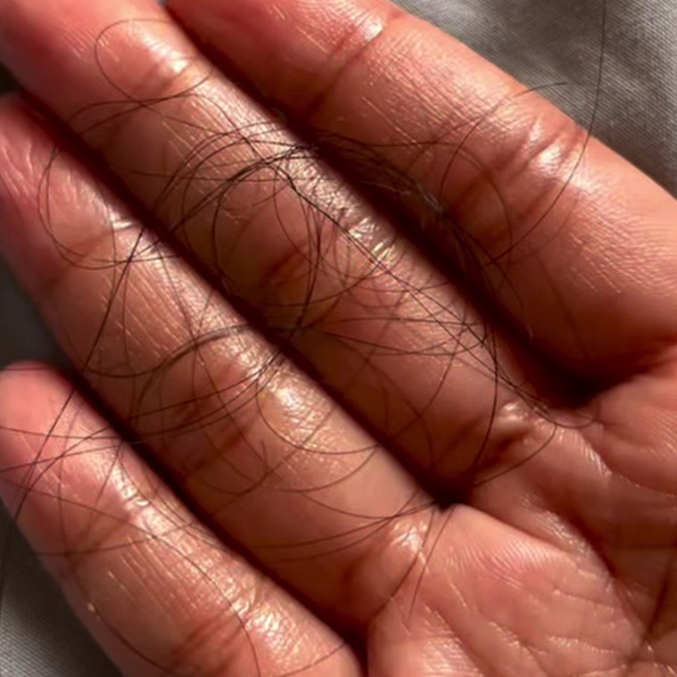 Tak perlu perawatan mahal, ini cara cegah rambut rontok dan uban cuma pakai 1 jenis bunga