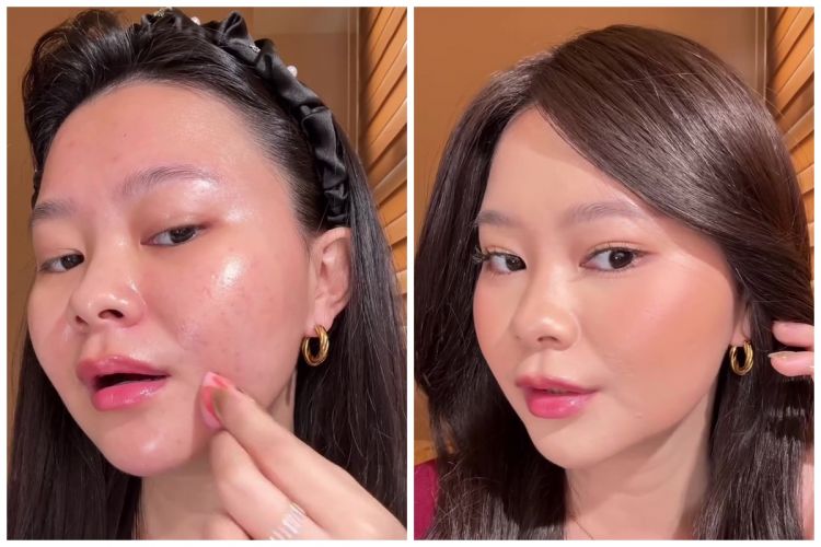 Tanpa foundation atau cushion, cewek ini bagikan trik samarkan bekas jerawat agar makeup lebih mulus