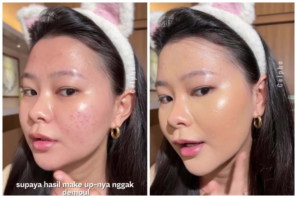 Concealer malah bikin bekas jerawat makin terlihat? Ini cara mengatasinya tanpa perlu tambahan produk