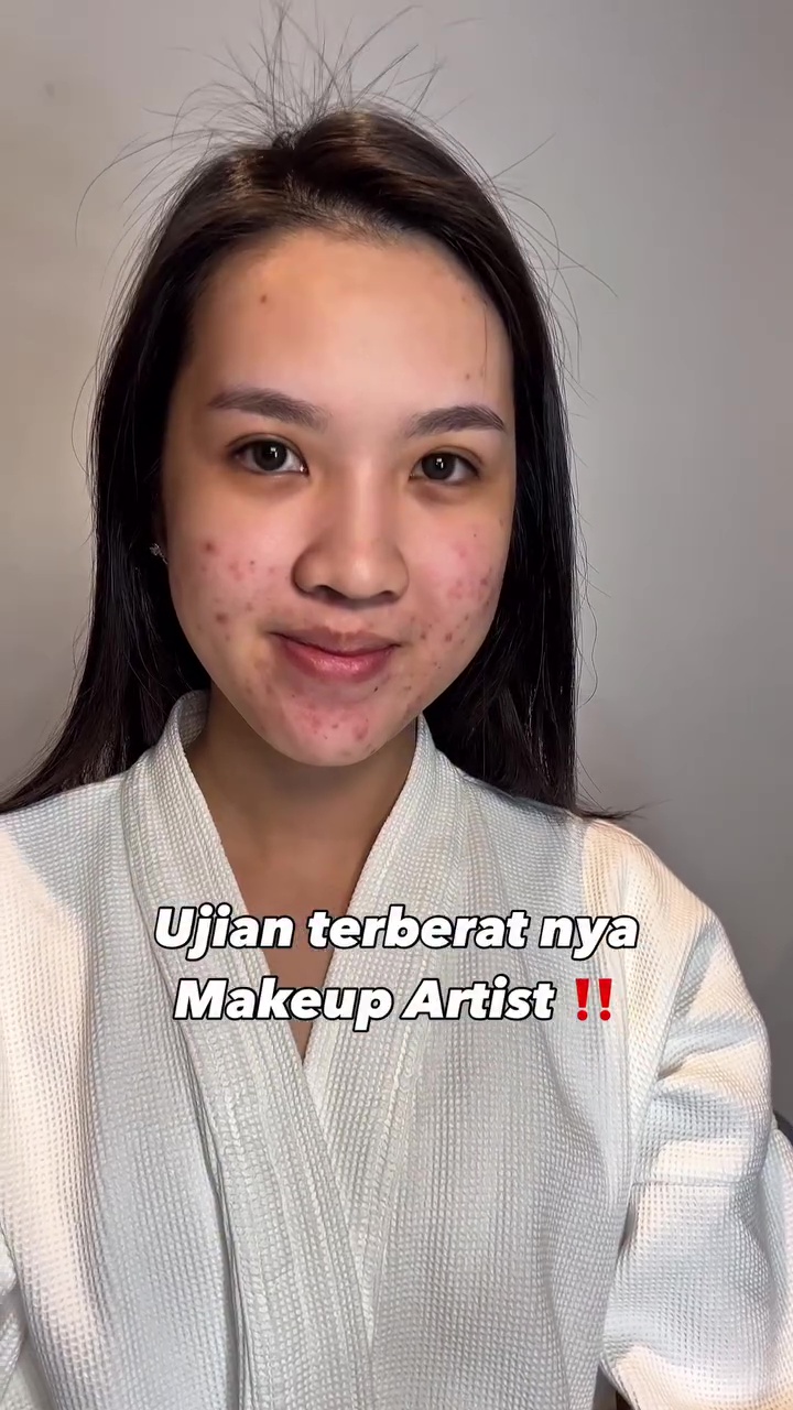 Transformasi makeup cewek berjerawat ini hasilnya natural nggak dempul, sang MUA bagikan triknya