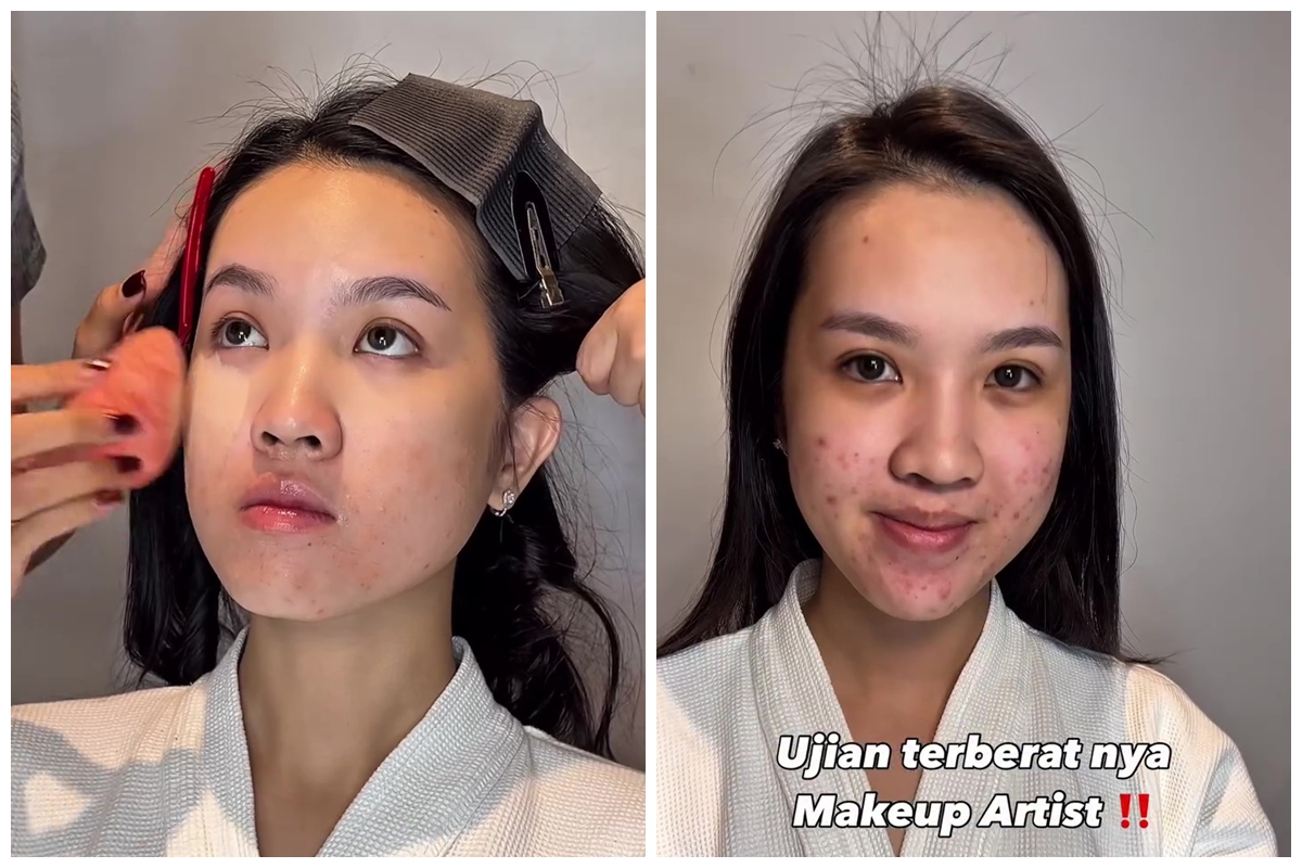 Transformasi makeup cewek berjerawat ini hasilnya natural nggak dempul, sang MUA bagikan triknya