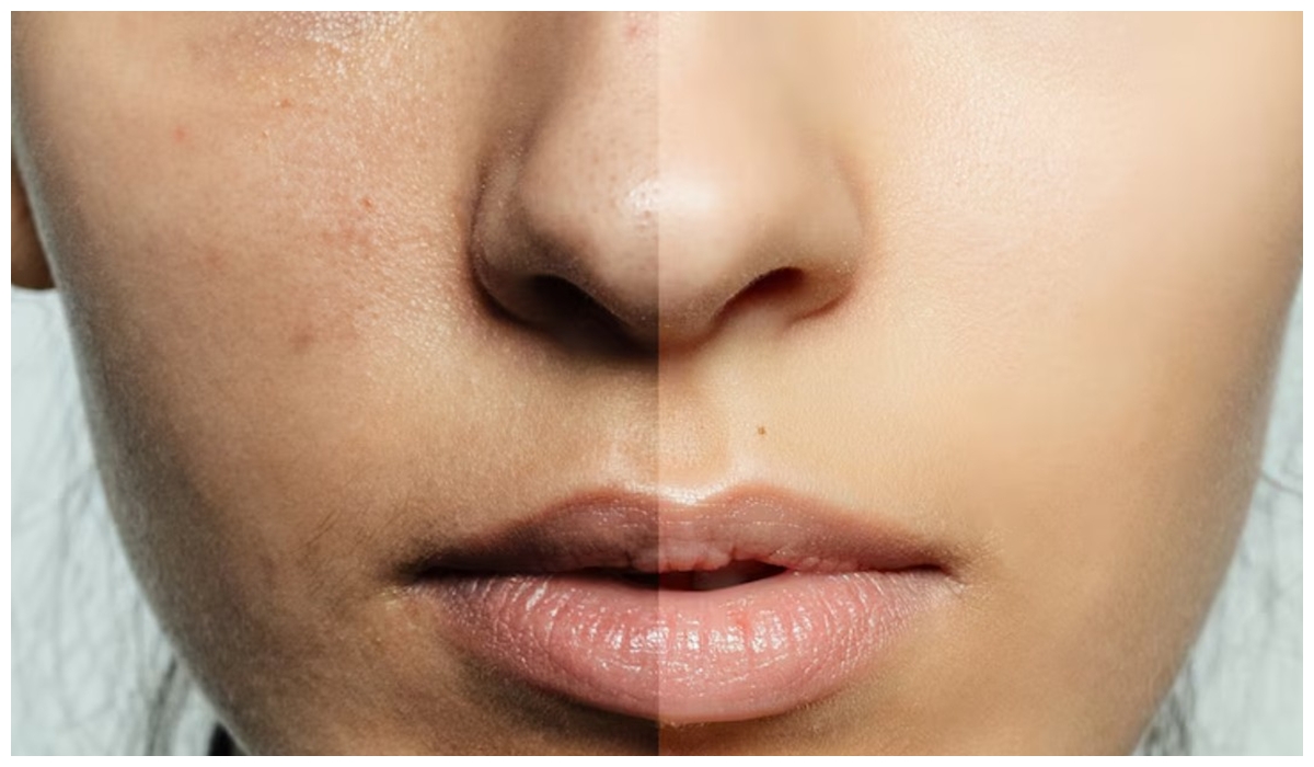 Cara atasi minyak berlebih di wajah tanpa bikin kulit kering pakai toner dari 1 jenis tanaman ini