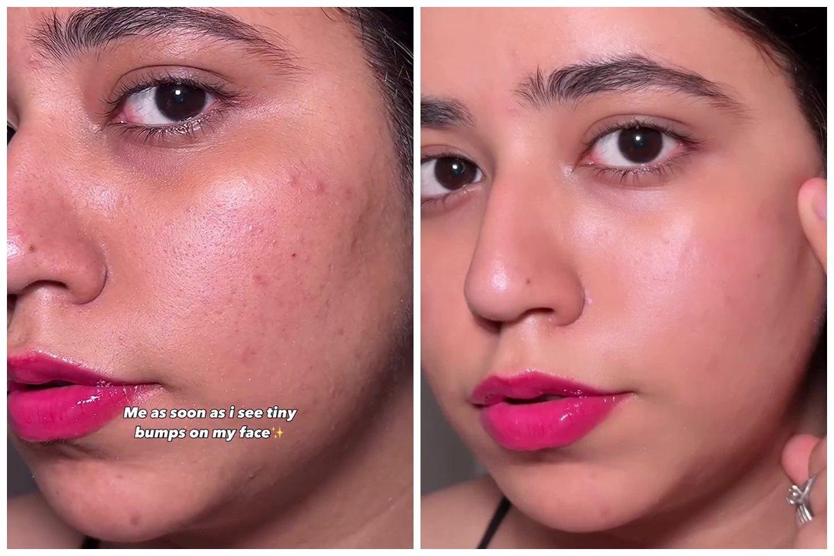 Beruntusan auto hilang dalam sekali usap, cara alami eksfoliasi wajah ini cuma butuh 2 bahan dapur