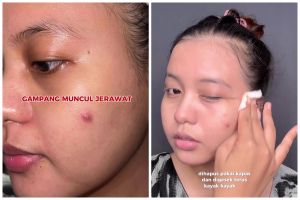 Tak perlu kapas, ini trik hapus makeup waterproof agar bersih maksimal tanpa bikin kulit jerawatan