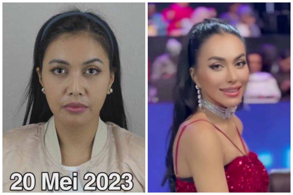 Pengakuan gamblang Denada sengaja operasi plastik, demi estetika untuk bertahan di industri hiburan