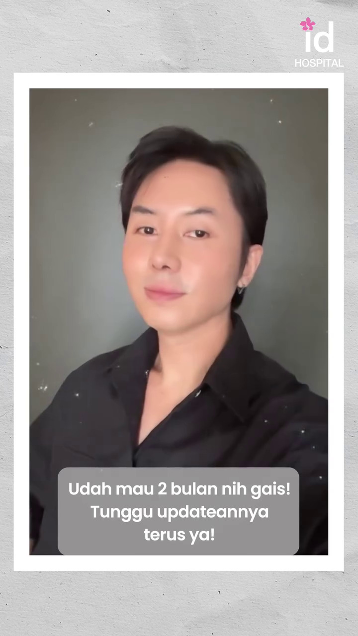 9 Potret transformasi Rafael Tan usai jalani oplas, perubahannya matanya jadi sorotan