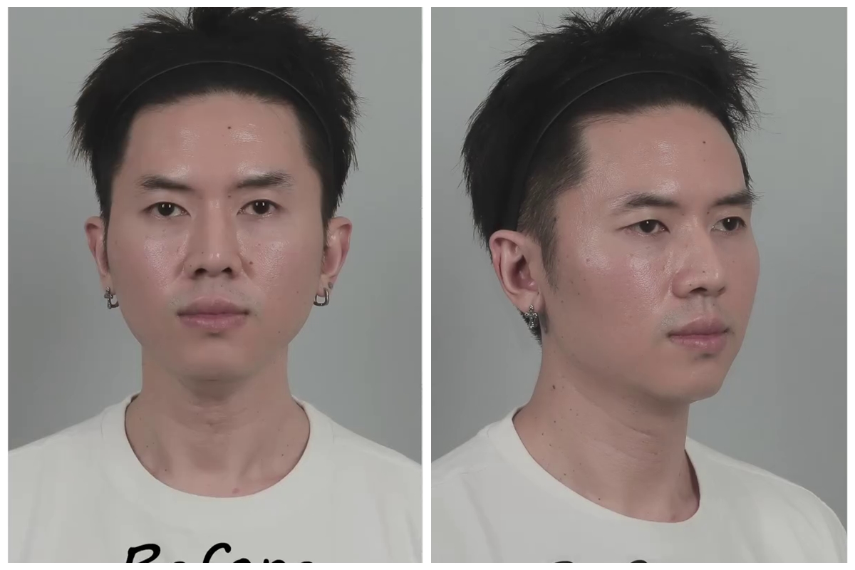 9 Potret transformasi Rafael Tan usai jalani oplas, perubahannya matanya jadi sorotan