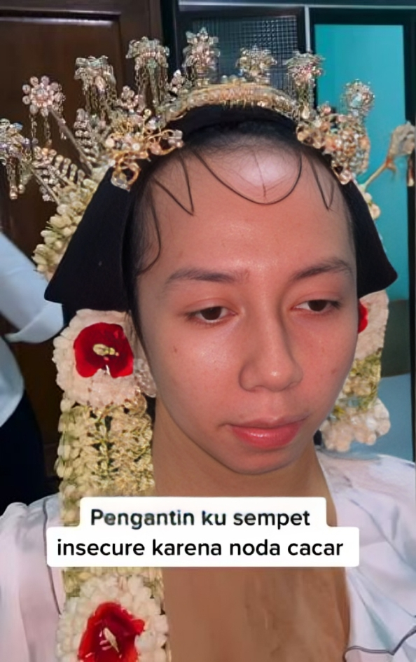 Bekas cacar hilang, transformasi makeup pengantin adat Jawa ini hasilnya bikin nggak nyesal pilih MUA