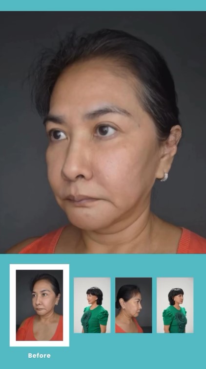 Yurike Prastika oplas anti-aging di Korea Selatan, 9 transformasinya jadi terlihat 10 tahun lebih muda