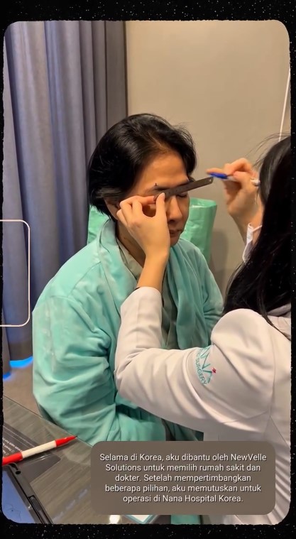 Yurike Prastika oplas anti-aging di Korea Selatan, 9 transformasinya jadi terlihat 10 tahun lebih muda