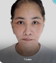 Yurike Prastika oplas anti-aging di Korea Selatan, 9 transformasinya jadi terlihat 10 tahun lebih muda