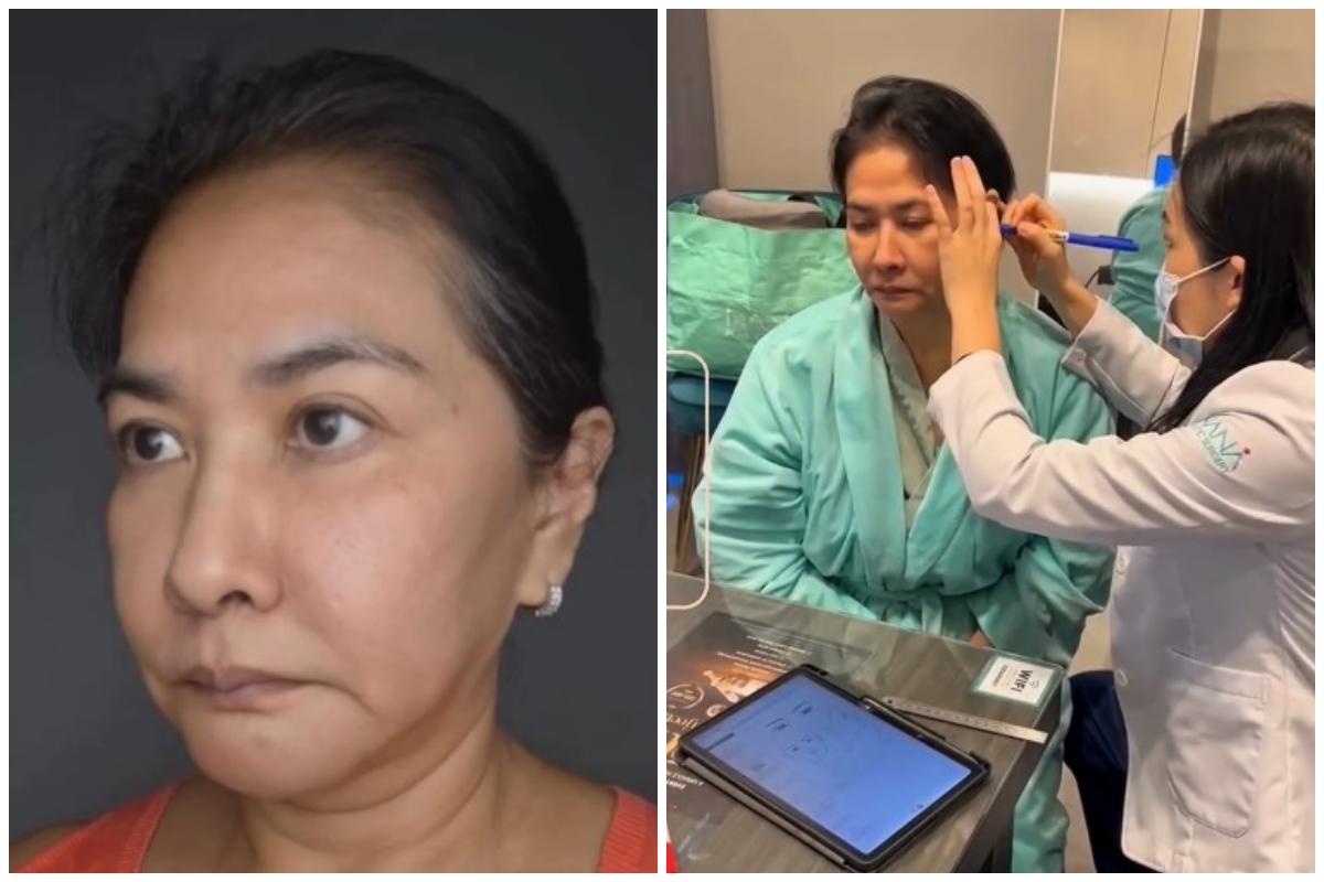 Yurike Prastika oplas anti-aging di Korea Selatan, 9 transformasinya jadi terlihat 10 tahun lebih muda