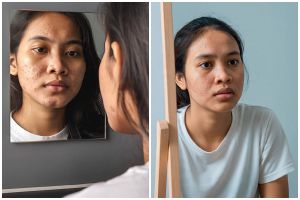 Ingin pori-pori kecil dan bebas komedo dalam waktu singkat? Coba 7 trik Ini di rumah