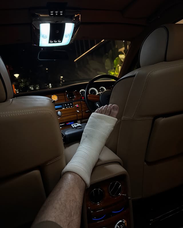 7 Potret kondisi terbaru Irwansyah pasca alami patah tulang, jalan dibantu pakai tongkat