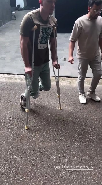 7 Potret kondisi terbaru Irwansyah pasca alami patah tulang, jalan dibantu pakai tongkat