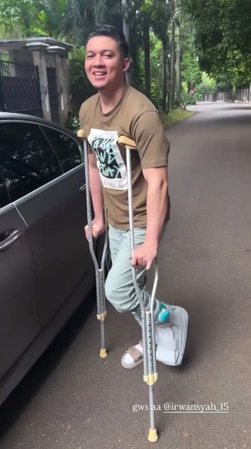 7 Potret kondisi terbaru Irwansyah pasca alami patah tulang, jalan dibantu pakai tongkat