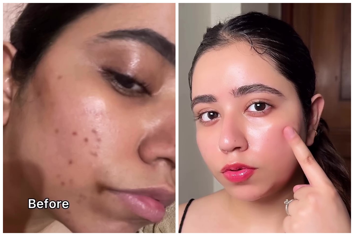 Jangan cuma direndam, ini cara bikin toner dari beras untuk hilangkan bekas jerawat dan flek hitam 