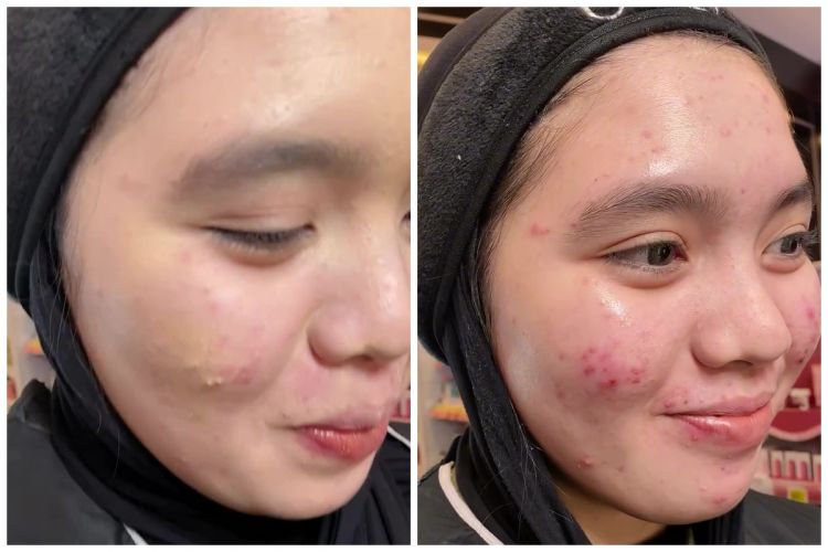 Salah pilih shade cushion bikin dempul, perubahan cewek dirias ulang ini auto mulus bak tanpa tekstur