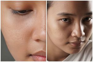 Sering salah pilih skincare? Ini 7 kandungan yang harus dihindari kulit berpori besar