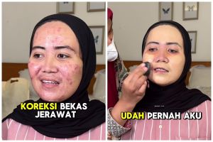 Punya jerawat kemerahan, transformasi pengantin jadi mulus bak perawatan usai dirias Korean makeup