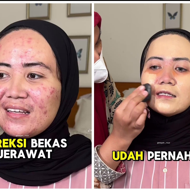 Punya jerawat kemerahan, transformasi pengantin jadi mulus bak perawatan usai dirias Korean makeup 