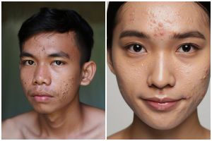 Jangan disamakan, ini perbedaan pori-pori pria dan wanita serta cara tepat merawatnya