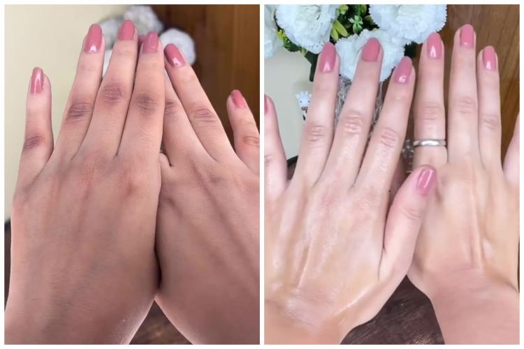 Bukan scrub atau produk eksfoliasi, ini cara baru atasi punggung tangan belang pakai 1 bahan dapur