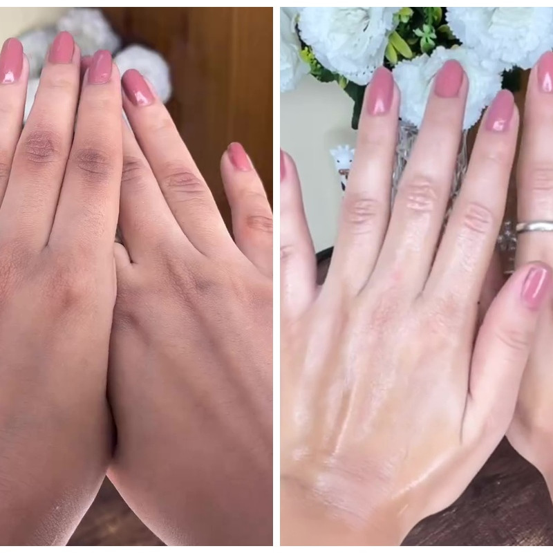 Bukan scrub atau produk eksfoliasi, ini cara baru atasi punggung tangan belang pakai 1 bahan dapur