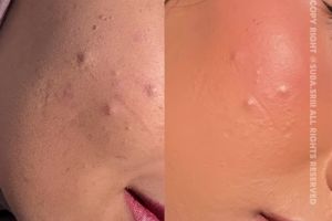 Pakai bedak padat masih sering cakey? Begini cara pakainya agar lebih flawless meski tanpa foundation