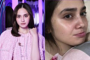 Sering makeup bikin wajahnya komedoan, ini cara Syifa Hadju eksfoliasi wajah agar mulus minim tekstur