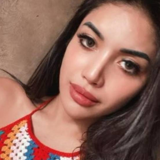 Wajahnya berubah 180 derajat usai filler bibir, intip 11 transformasi Millen Cyrus yang tuai sorotan