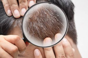 Capek semir rambut buat tutupi uban? Coba pakai 2 bahan minuman ini hasilnya auto hitam