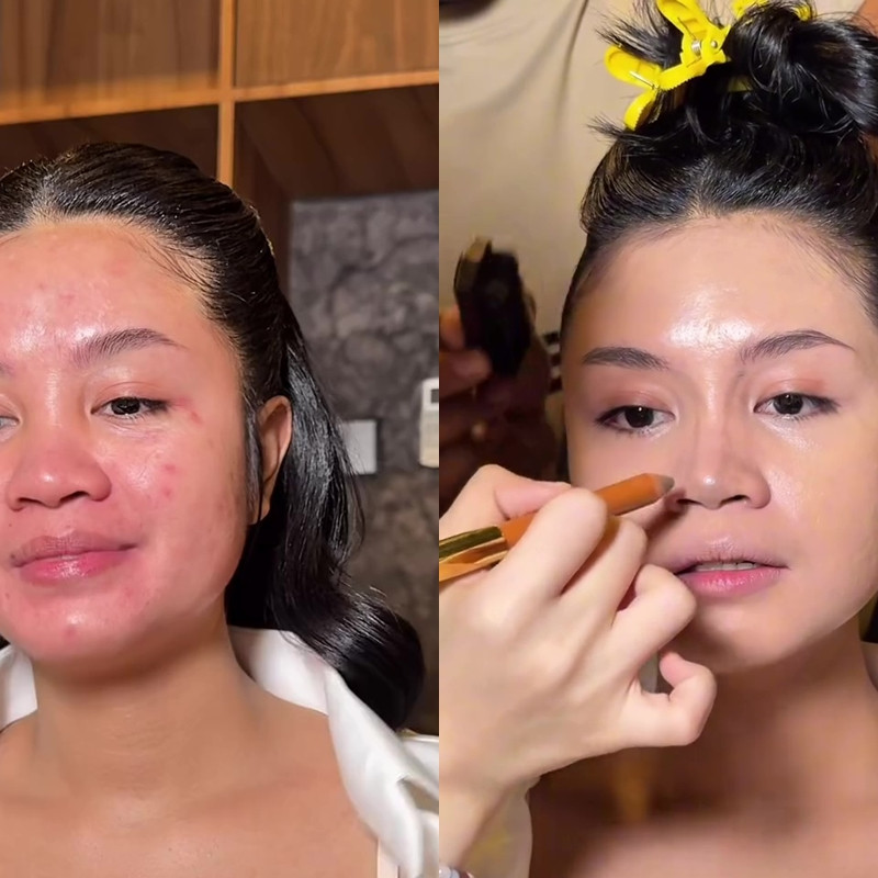 Kulit kemerahan karena bekas jerawat, transformasi makeup cewek ini auto flawless bak hasil perawatan
