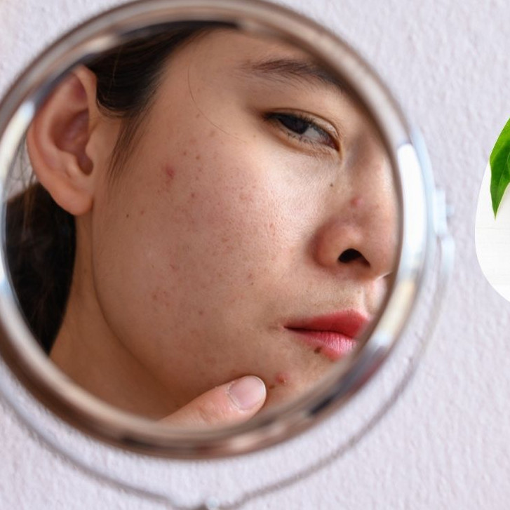 Pori-pori kotor dan tampak besar? Ini cara bersihkan dan mengecilkannya, kulit mulus dalam sekejap