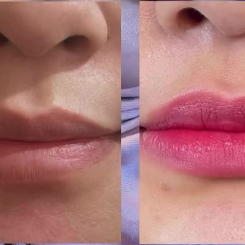 Cuma butuh 2 minggu, ini rahasia cerahkan bibir gelap dan kusam jadi pink alami tanpa bahan kimia