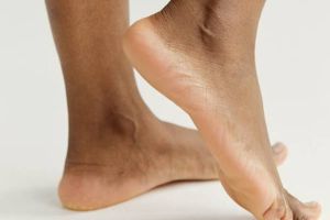 Tumit kaki pecah-pecah dan berwarna hitam? Haluskan pakai 1 bahan herbal, auto mulus dalam 10 menit