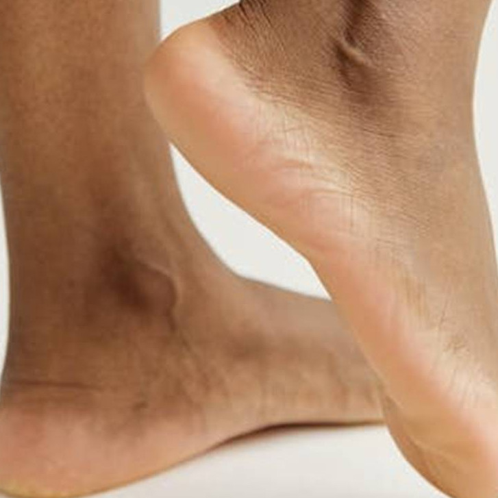 Tumit kaki pecah-pecah dan berwarna hitam? Haluskan pakai 1 bahan herbal, auto mulus dalam 10 menit