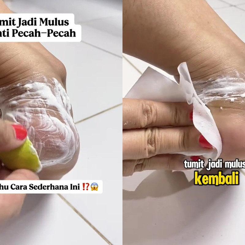 Tumit kering dan pecah-pecah auto mulus dalam 10 menit bermodal 3 bahan dapur, begini cara pakainya
