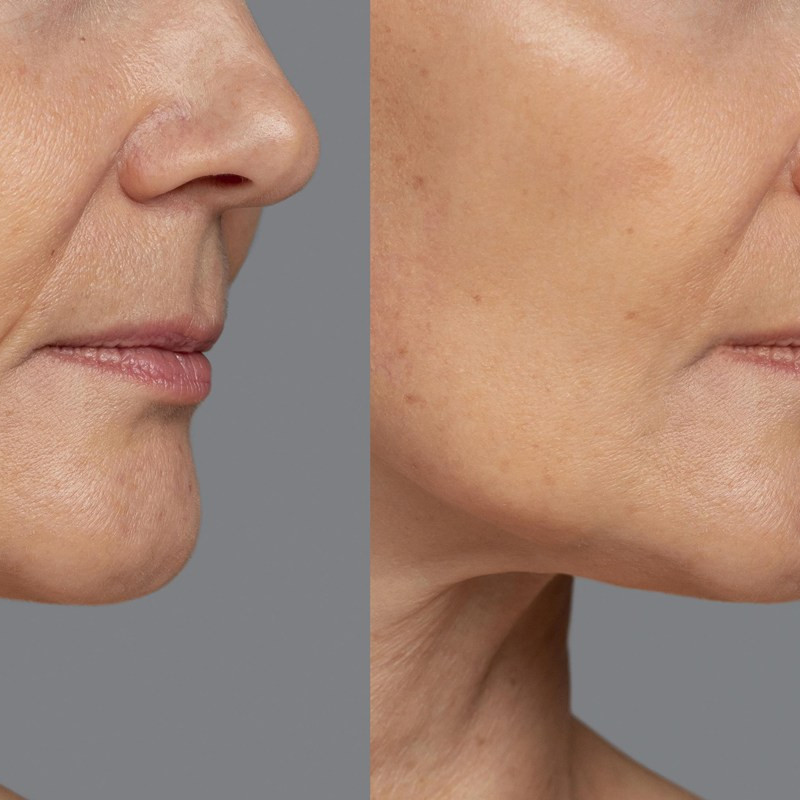 Cuma butuh 3 jenis buah, ini cara bikin minuman kolagen untuk kencangkan kulit dan hempaskan kerutan